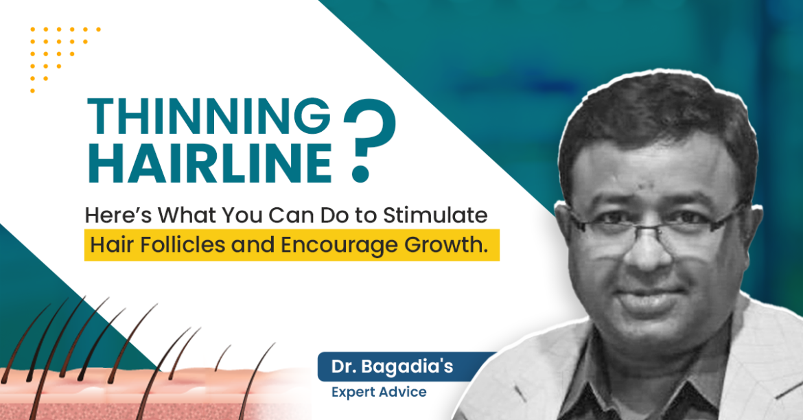 Thinning hairline tips by Dr. Bagadia: Advice on stimulating hair follicles and encouraging growth, featuring hair strand illustration.